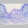 Pancreas SF 16.jpg